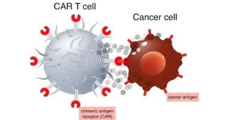 非病毒CAR-T細胞療法：癌癥治療的“無病毒”革命？